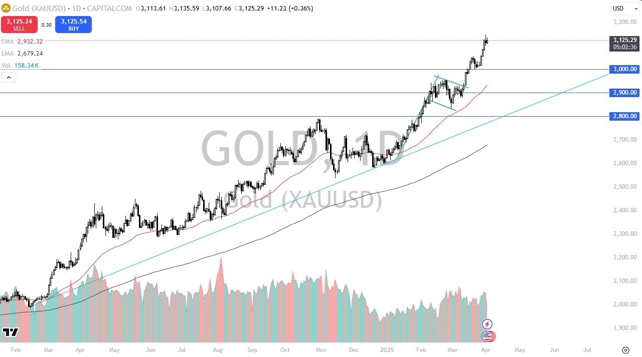 【XM Market Review】--Gold Forecast: Attracting Buyers(图1)
